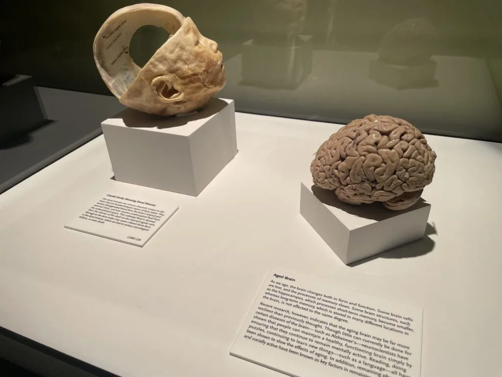 Human Brain specimen sitting in a case next to the skull specimen that it came from, which is cut open to show the opening in the head caused by removal of the brain. 