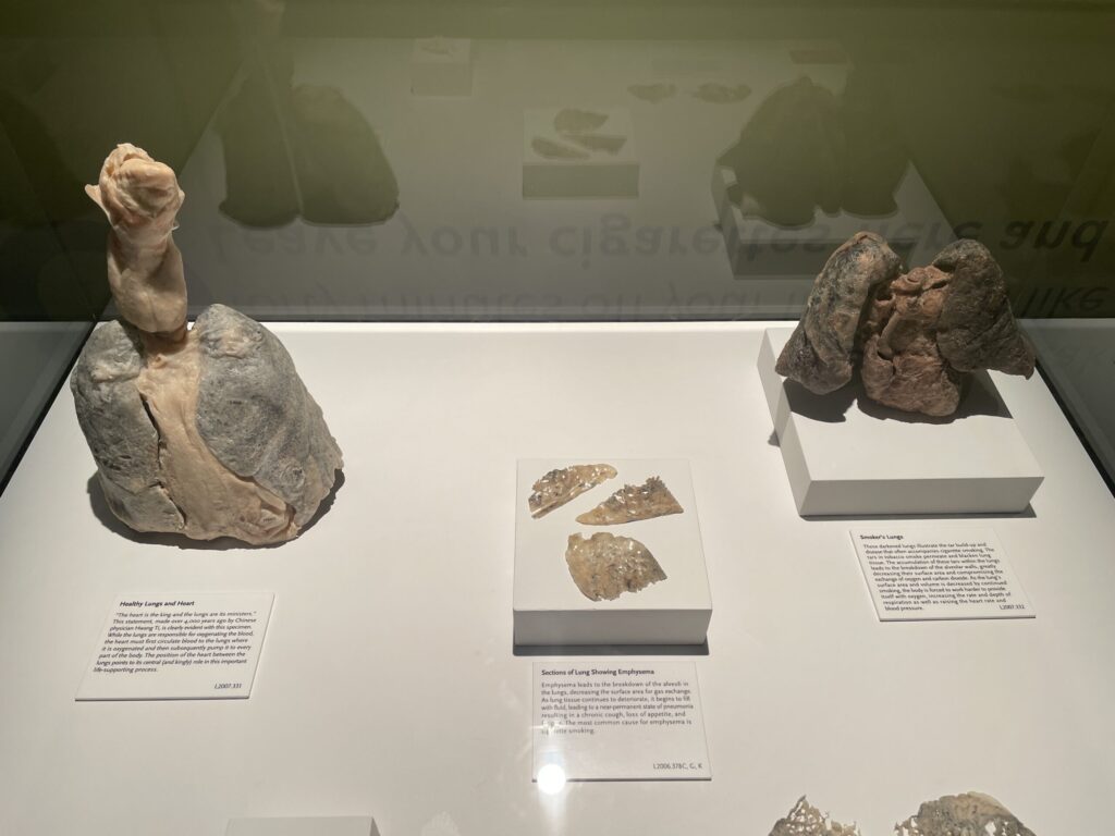 A non-smokers clean lungs are on the left, while the black and withered smoker's lungs are on the right.