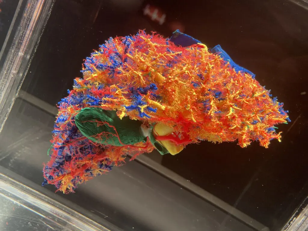 Colorful polymer depiction of the blood vessels in a human liver. 