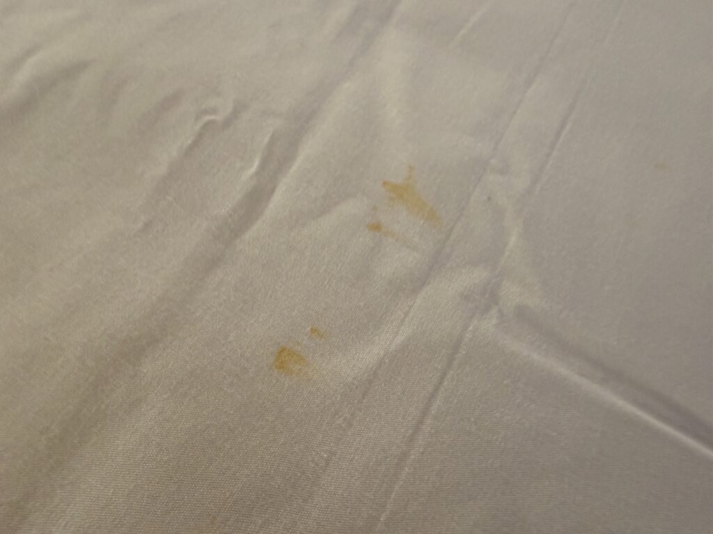 Yellow staining on the bedding.